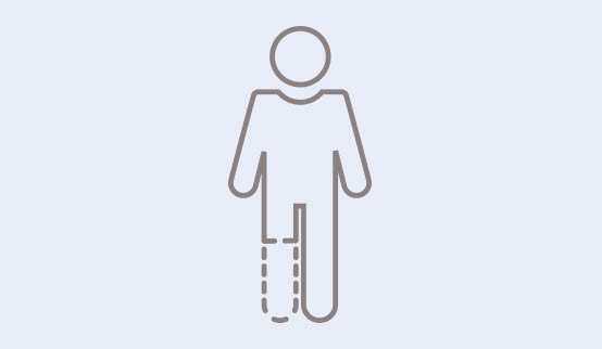 A symbol showing a person with an amputated leg. 